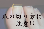 爪の切り方に注意